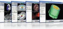 OncoView is a new image management and storage solution by Varian Medical Systems.
