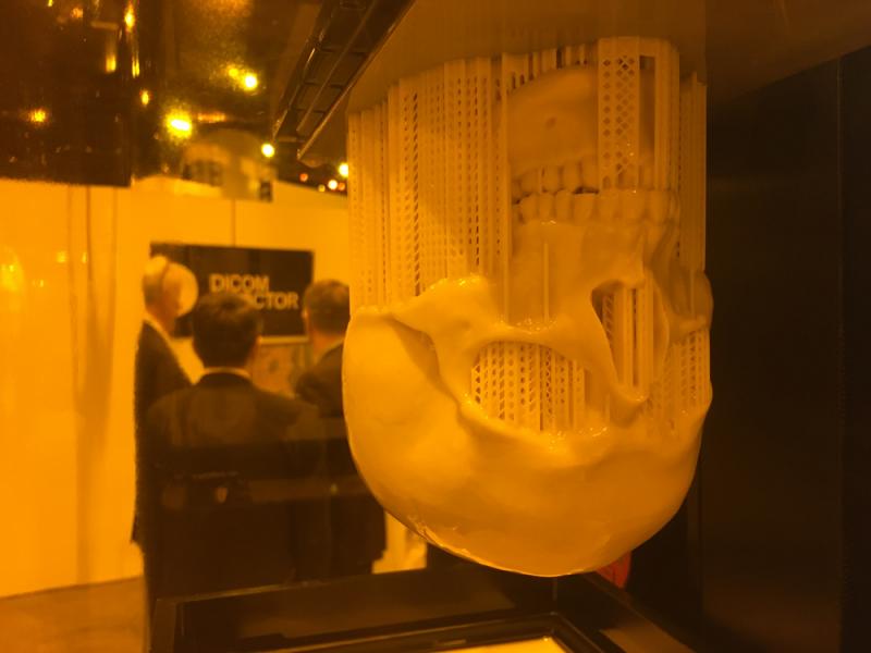 A 3-D printed skull still in the printer, created from a CT scan in the Envision TEC booth at RSNA 2019. 
