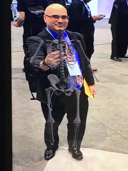 ITN Editor Dave Fornell. Software being shown by GE Healthcare, showing how augmented reality can be used for patient education. It superimposes a full skeleton onto a patient on a large display screen and as they move the skeleton moves with them. 