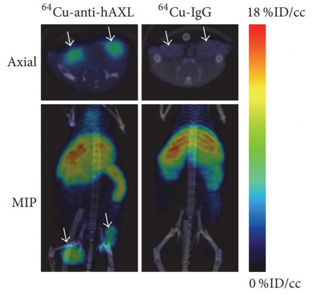 PET/CT images of MDA-MB-231 tumor xenografts in mice 24 hours after intravenous injection with 64Cu-anti-hAXL. Treatment group received daily 17-AAG injections and showed lower tumor uptake of 64Cu-anti-hAXL than the vehicle-treated control group. 