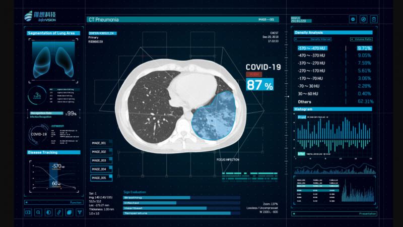AI vendor Infervision's InferRead CT Pneumonia software uses artificial intelligence-assisted diagnosis tp improve the overall efficiency of the radiology department. It is being delayed in China as a high sensitivity detection aid for novel coronavirus pneumonia (COVID-19). #COVID-19 #COVID19 #Coronavirus #2019-nCoV