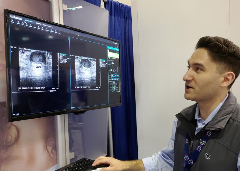 Koios software identifies suspicious lesions in ultrasound images during a demonstration on the exhibit floor of the Society for Breast Imaging (SBI)/American College of Radiology (ACR) Breast Imaging Symposium in April. Photo by Greg Freiherr