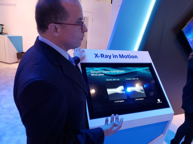Konica Minolta showcased at RSNA 2018 a work-in-progress that gives new meaning to the word “dynamic.” 