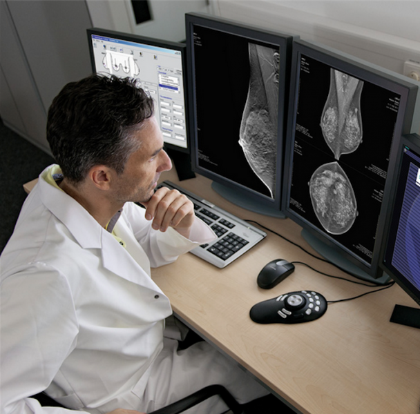 About 25 percent of screening patients and 60 percent of diagnostic patients do not have prior mammograms available for comparison at the time of their examinations due to the lack of interoperability or other restrictions preventing clinicians from accessing prior exams.