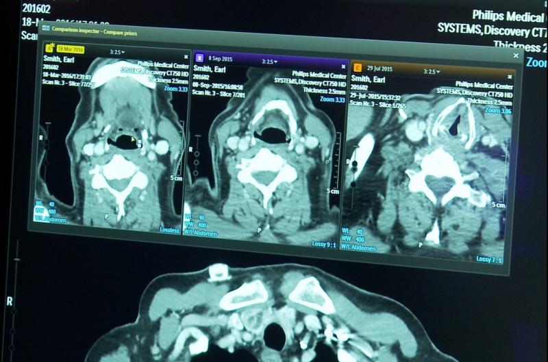 Philips’ AI-based Illumeo software suggests tools to be used in the comparison of current and prior patient images.