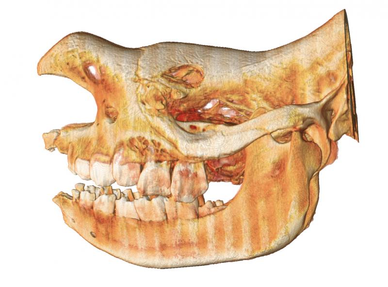  Rhinoceros CT Scan