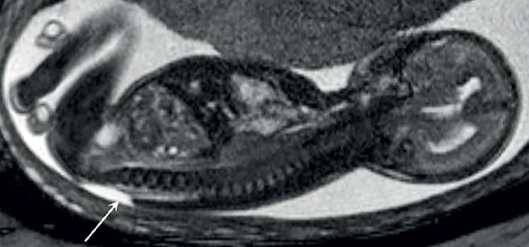 Fetal MRI image slider