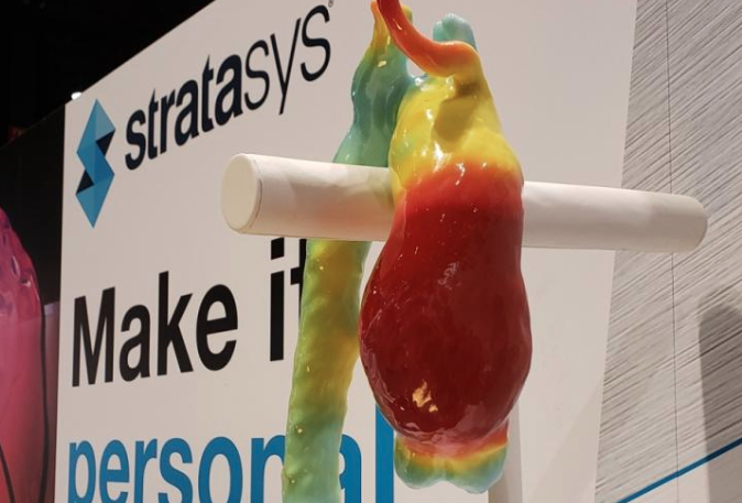 At RSNA 2018, Stratasys showed how 3-D printed models can help plan surgeries and assist in making complex diagnoses.