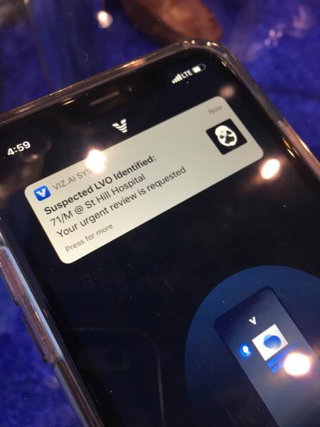 A notification on a physician's phone showing a automated potential stroke alert on their iPhone from the FDA-cleared Viz.AI app. 