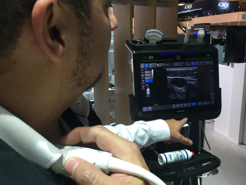 This is the new Point of care ultrasound (POCUS) system introduced by GE Healthcare at RSNA 2019 this week. The Venue Go system offers simple operation, drop down menus for specific types of exams. Several vendors said they are seeing a large amount of growth in the POCUS market.