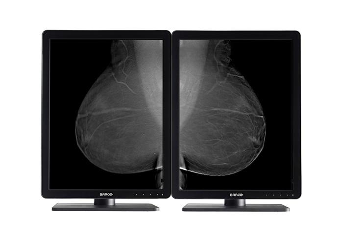 Flat panel displays, barco nio, mammography