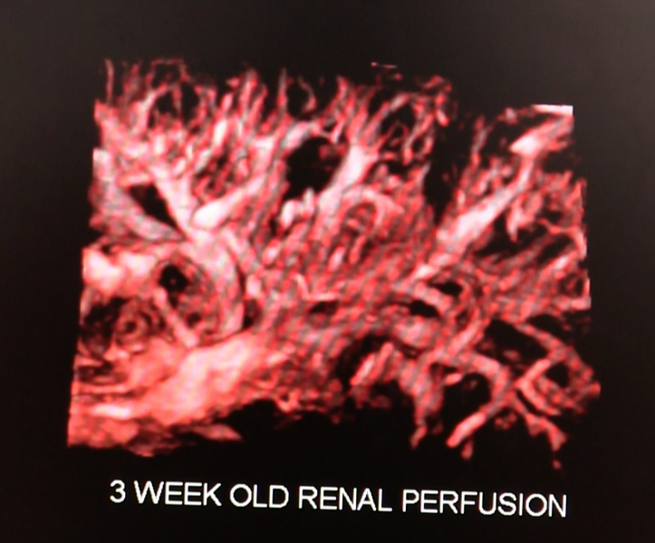 Toshiba's SMI 3-D software for its Aplio ultrasound systems enables 3-D/4-D imaging of low perfusion vessels in organs. This example is a reconstruction of four-month old fetal renal perfusion.
