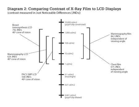 Comparing Contrast of X-Ray Film to LCD Displays