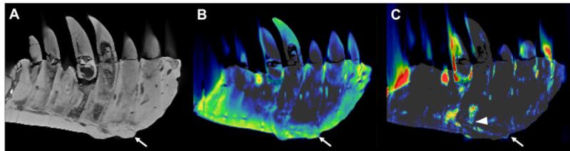 Figure 2. CT reconstructions of the tooth-bearing part of the left dentary. (A) Reconstruction of the conventional CT images in lateral view showing well-preserved anatomical structures such as the replacement teeth. The arrow indicates the focal exophytic mass—the abnormal growth that sticks out from the surface of the tissue—on the ventral surface at the level of the 3rd to 5th tooth roots. (B) The DECT-based calcium material map shows a homogeneous mineral distribution, while (C) the fluorine material ma