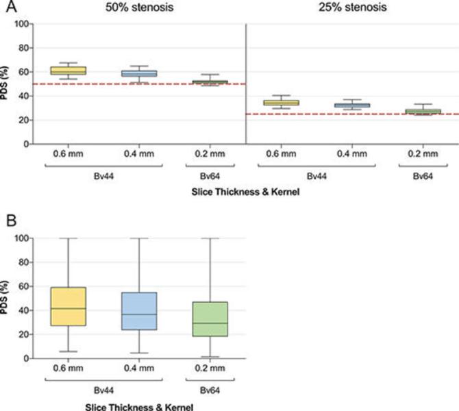  Boxplots show percentage diameter stenosis (PDS) values for both (A) in vitro (50% and 25%) and (B) in vivo stenoses, measured using reconstructions with different section thicknesses