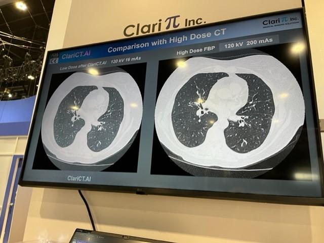 The CT image denoising solution shown here during RSNA 2022 from ClariPi removes noise and enhances image clarity based on deep-learning technology for a more efficient workflow according to the company.