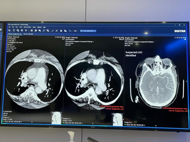 “During this past year, we have helped a number of healthcare providers increase their efficiency within radiology. Many regards resource and workload sharing as critical in maintaining excellent patient care in a reality of increasing pressure on radiology,” says Marie Ekström Trägårdh, President of Sectra Imaging IT Solutions.