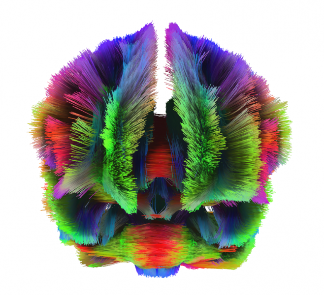 Diffusion tractography allows us to observe the white matter in the brain, which serve as communication pathways between different regions of the brain.