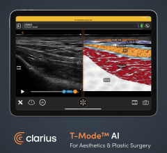 T-Mode AI by Clarius creates a split screen during an exam that displays a colorful anatomical image with labels next to the grayscale ultrasound image