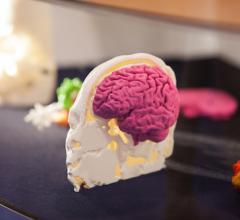 Philips, Ultimaker, MRI scans, 3-D printing, replicas, ISMRM