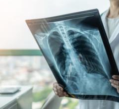 A new artificial intelligence (AI) algorithm can identify when medical images are likely to be difficult for either a radiologist or AI to make an effective diagnosis.