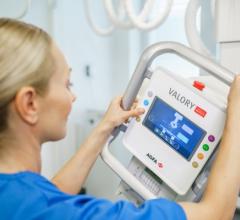 At RSNA 2021, Agfa launched its new VALORY digital radiography (DR) room. VALORY delivers a simple design with functionality that goes far beyond the “basics,” bringing reliability, productivity and “first-time-right” imaging into reach for any hospital.