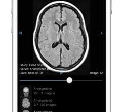 Ambra Health Launches Mobile App for Instant Medical Image Access