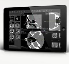 Ambra Health announced the launch of Ambra ProViewer, the company's next generation cloud-based diagnostic image viewer built for today's needs. ProViewer joins Ambra Health's revamped suite of imaging tools and enables advanced anytime, anywhere access to medical imaging.