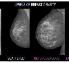 Volpara's breast density scale