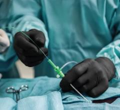 Radiation Protection Gloves Provide Hand Protection in Radiation-Guided Surgical Procedures