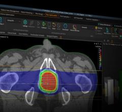 #RSNA19 The Swedish MedTech company will demo the machine learning capabilities of its flagship RayStation and RayCare systems