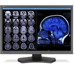 multiple sclerosis MS patients, rs-fMRI, neuro imaging, video games, Radiology journal