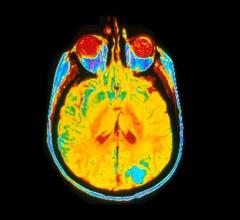 A single image of a human brain using a magnetic resonance imaging (MRI) machine. Image courtesy of Dr Leon Kaufman. University Of California, San Francisco