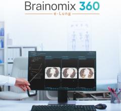 Brainomix, Endeavor BioMedicines Present Positive AI Imaging Results in IPF Clinical Trial