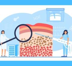 Study Finds Imaging Technique Can Reduce Benign Breast Biopsies by 25%