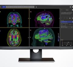 Stryker's Advanced Guidance Technologies Partners With Synaptive Medical and Ziehm Imaging