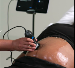 ultrasound, gestational, portable