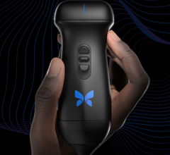 Butterfly Network Extends Proprietary 3D Imaging Capabilities to Developers