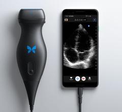 Butterfly iQ devices provide revolutionary portable ultrasound capabilities for faster and easier screening and monitoring