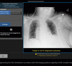 New AI suite includes algorithms that help radiologists prioritize critical cases and automate processes to help cut average review time from up to eight hours