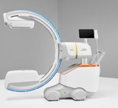 Siemens Healthineers has announced the Food and Drug Administration (FDA) clearance of the CIARTIC Move, a mobile C-arm with self-driving capabilities.