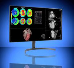 Double Black Imaging (DBI) announced the immediate availability of two radiology-focused medical-grade displays from LG Electronics bundled with DBI’s comprehensive calibration software package.