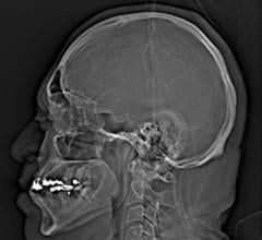 Study Shows Number of Head CT Scans in ERs More than Doubles Over 15 Years