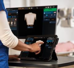 With Carestream’s DR Retrofit systems, imaging facilities that have not yet fully upgraded to DR can move forward to full wireless DR imaging at a fraction of the cost of purchasing a new system. Carestream’s retrofit solutions