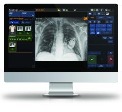 Carestream Health will highlight its advanced capabilities in bedside and DR room imaging solutions — with the DRX-Revolution Mobile X-ray System, DRX-Compass X-ray System and the DRX-Evolution Plus — at the upcoming virtual Radiological Society of North America (RSNA) conference.