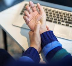 Data on Office-Based Ultrasound-Guided Carpal Tunnel Release Study Released