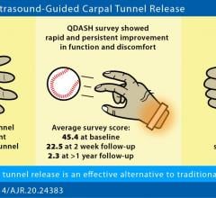 Ultrasound-guided carpal tunnel release quickly improves hand function and reduces hand discomfort, making the procedure a safe, effective, and less invasive alternative to traditional open or endoscopic surgery