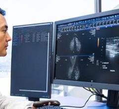 Cloud-native solutions are now available for both radiology and cardiovascular customers 