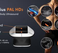 New Clarius PAL HD3 wireless handheld whole-body ultrasound scanner uniquely combines phased and linear arrays on a single head