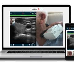 Clarius Releases Clarius Live Ultrasound Telemedicine Solution